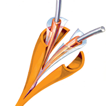 57-xlt